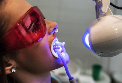 Teeth Whitening Service Philips Zoom in Mount Roskill Auckland